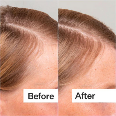 Veganic Natural Hair Growth Oil