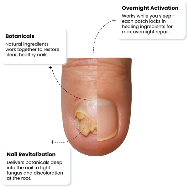 Quick Fix Nail Care Patches
