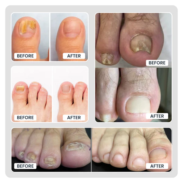 Quick Fix Nail Care Patches