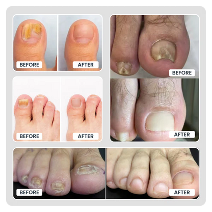 Quick Fix Nail Care Patches