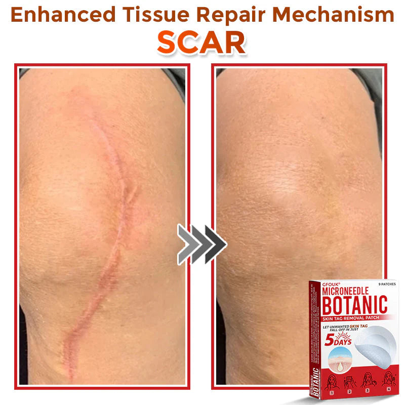 MicroNeedle Botanic Tag Patch