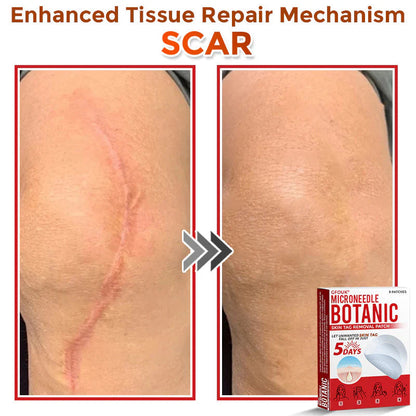 MicroNeedle Botanic Tag Patch