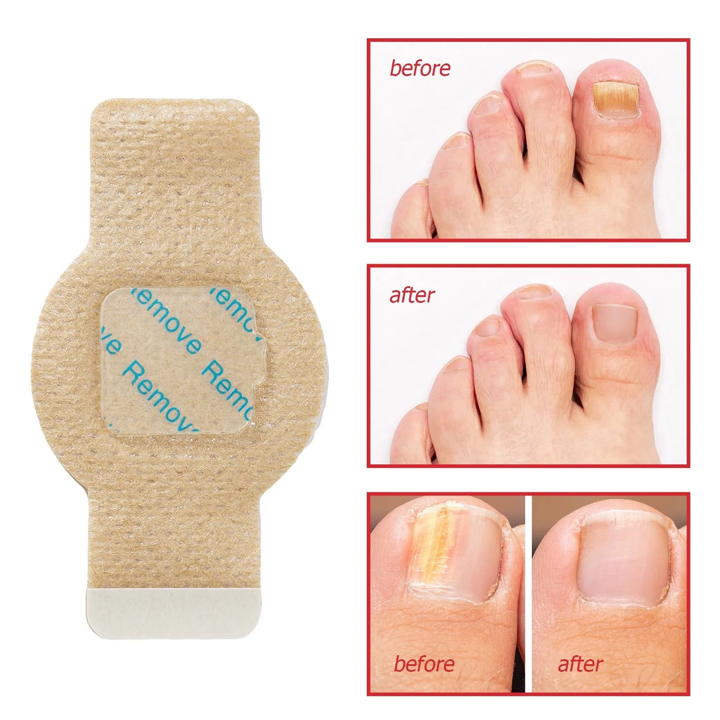 Quick Fix Nail Care Patches