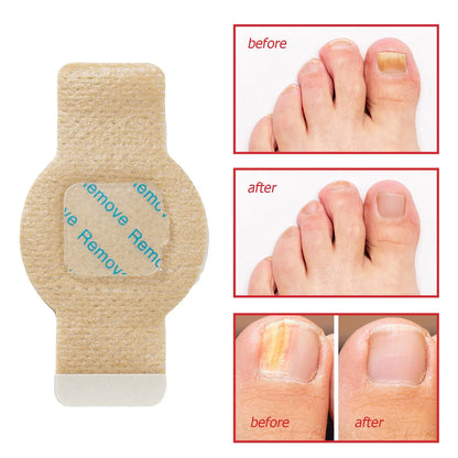Quick Fix Nail Care Patches