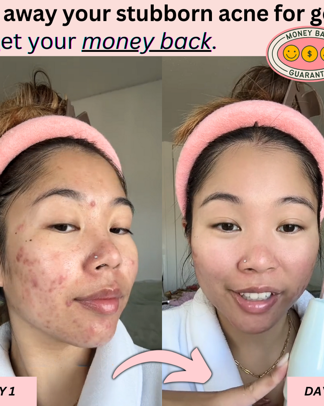 Clear Skin Magic Wand ™