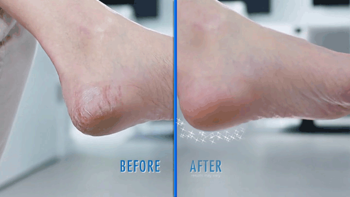 Smooth Foot Spa Buddy
