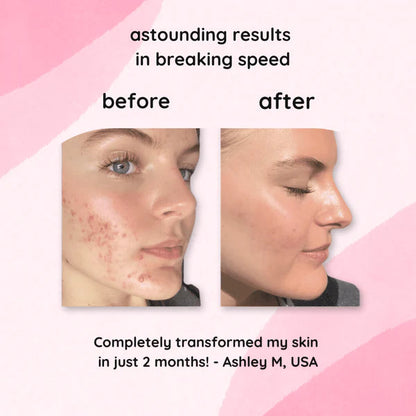 GlowFix® Skin Glow Pads