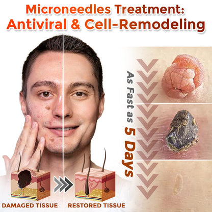 MicroNeedle Botanic Tag Patch