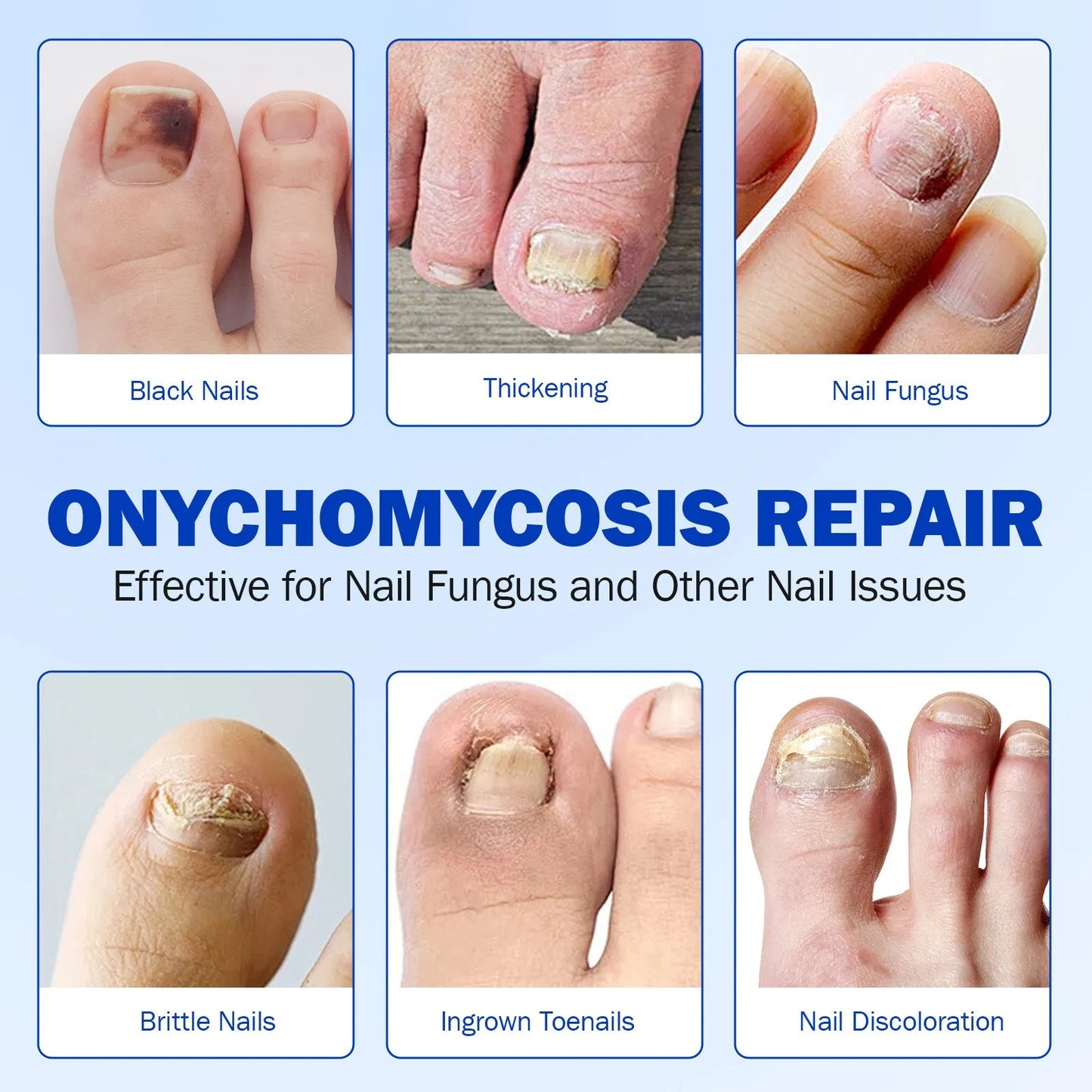 Quick Fix Nail Care Patches