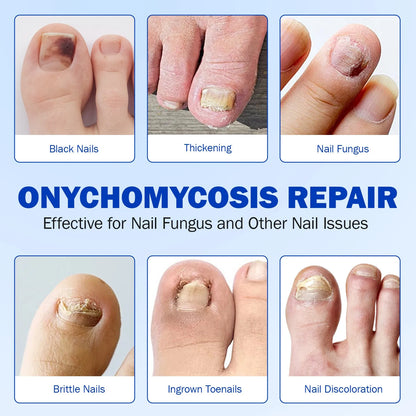 Quick Fix Nail Care Patches