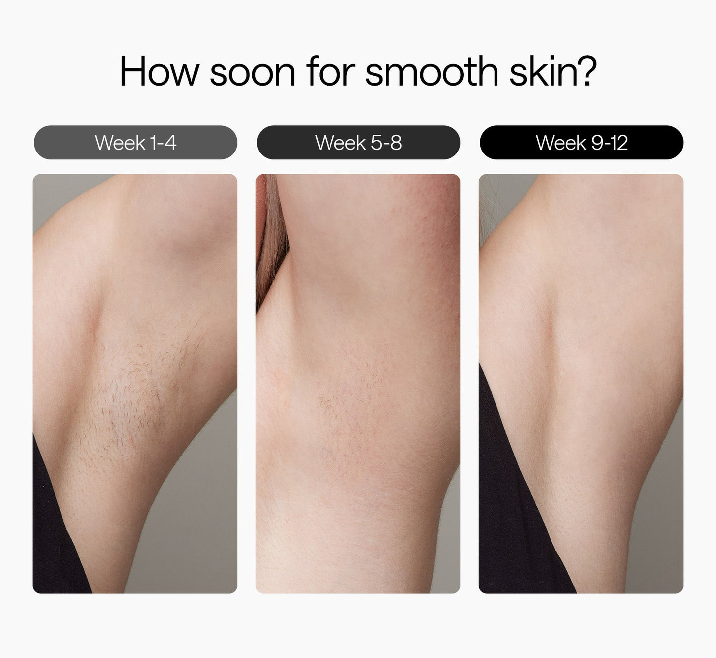 SmoothGlow Hair Remover